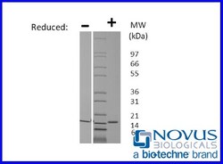 Novus Biologicals Recombinant Porcine Flt-3 Ligand Animal-Free Protein 100 &mu;g | Buy Online | Novus Biologicals&trade; | Fisher Scientific